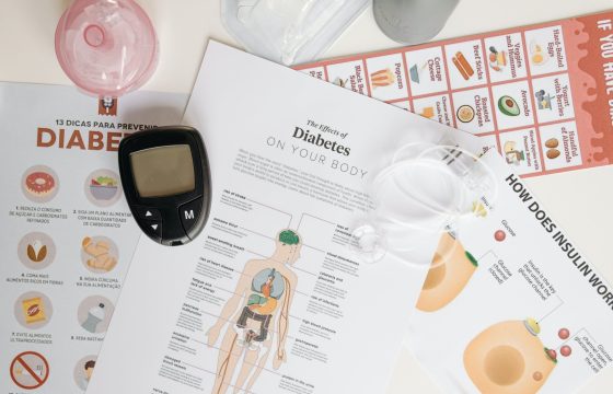 Type 2 Diabetes Treatment Factors Ask Expert